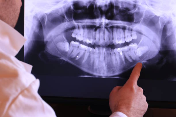 Best Emergency Tooth Extraction in Maugansville, MD